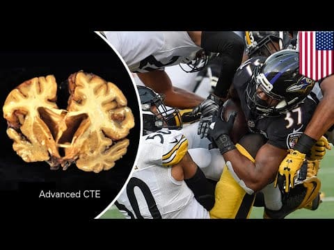 Brain disease CTE found in 99% of NFL players, latest brain study shows – TomoNews