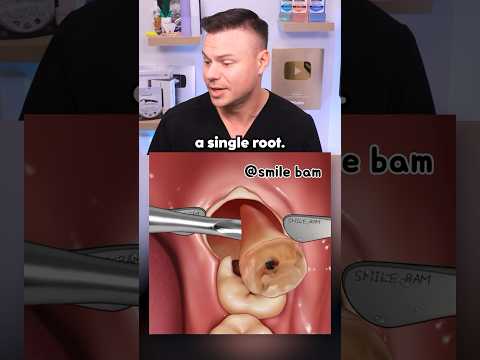 What REALLY Happens During Wisdom Teeth Removal! 🦷😯