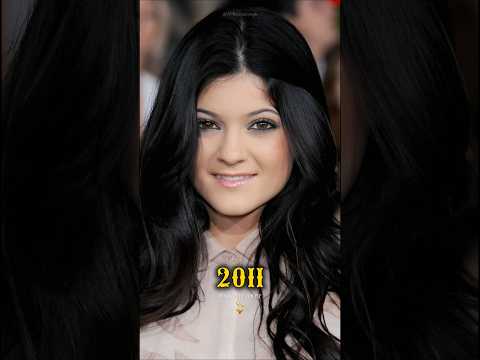 Fascinating Evolution of Kylie Jenner🧚‍♀️💫 #kyliejenner #shorts #celebrity #evolution