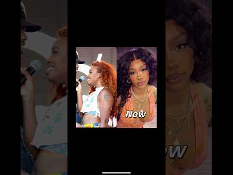 SZA surgeries #nickiminaj #sza #hiphopartist #barbz