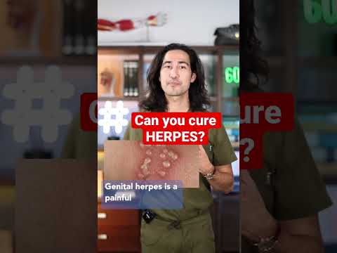 Can you CURE HERPES?