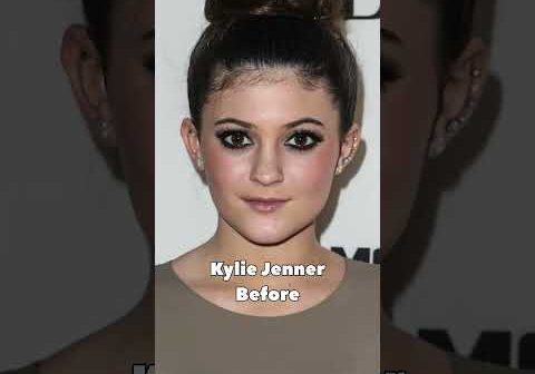 KYLIE JENNER before and after her plastic surgery #trending