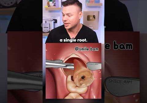 What REALLY Happens During Wisdom Teeth Removal! 🦷😯