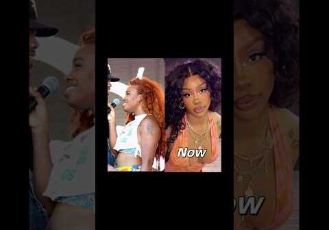SZA surgeries #nickiminaj #sza #hiphopartist #barbz