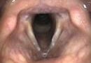 Anatomical Tutorial During Trans-Nasal Endoscopy
