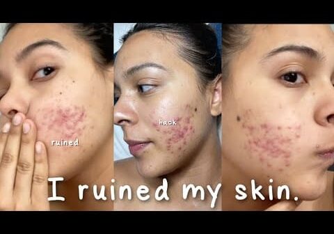 I Ruined My Skin with this Beauty Hack… #shorts #skincare