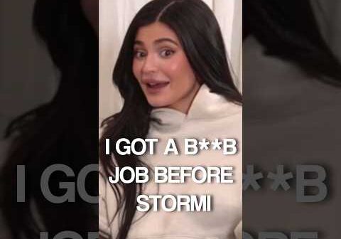 The Truth Behind Kylie Jenner’s Pre-Pregnancy Cosmetic Surgery🤰🏻💄#shorts #kyliejenner #kardashian